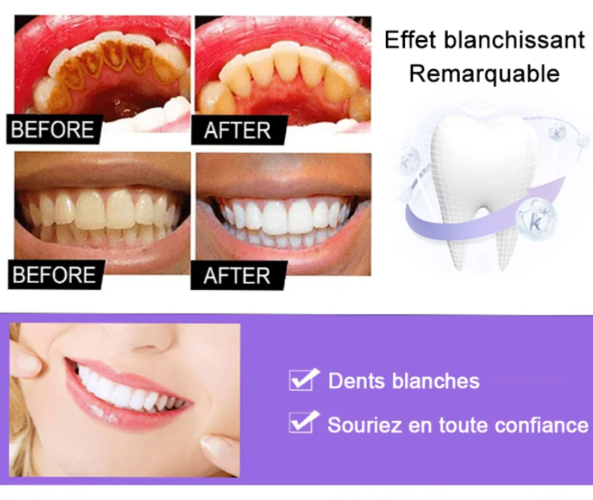 Pack(2 boites) Blanchiment instantané des dents pour Hommes et Femmes